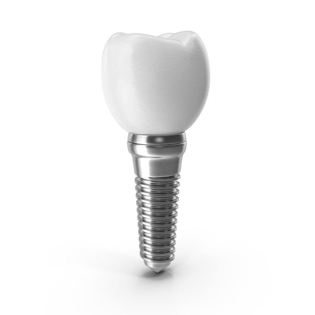 implantes dentales en bogota