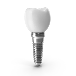 implantes dentales en bogota